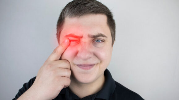 A,Man,Suffers,From,Pain,In,The,Eye.,Patient,With