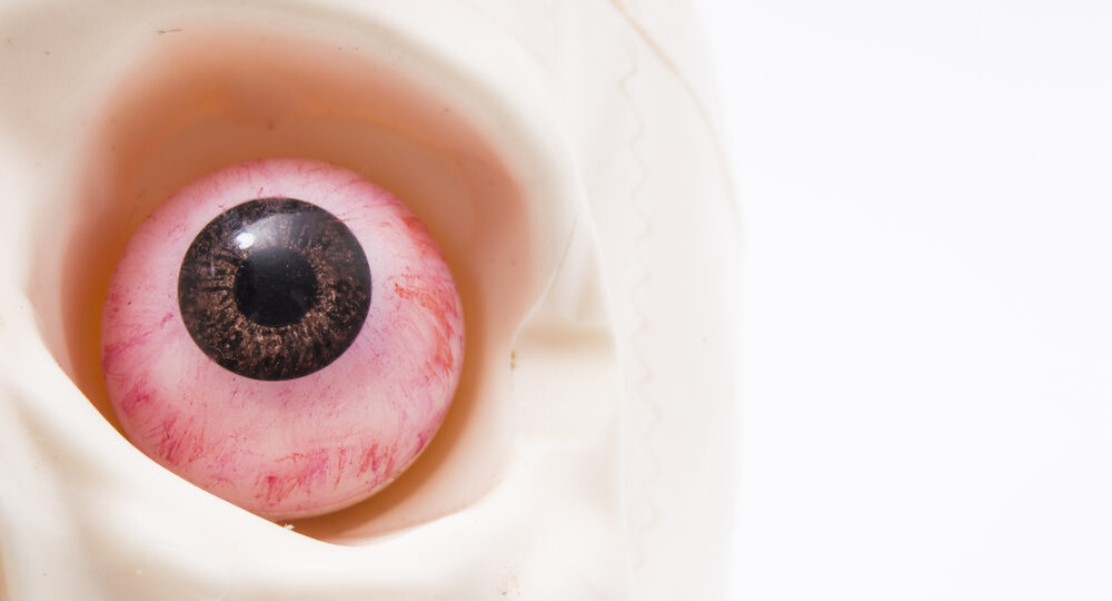 The,Human,Eye,With,The,Pronounced,Blood,Vessels,In,The