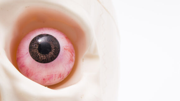 The,Human,Eye,With,The,Pronounced,Blood,Vessels,In,The