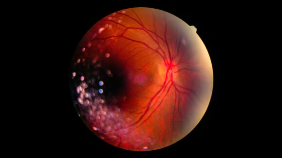 ROCHE_WEB THUMBNAIL
