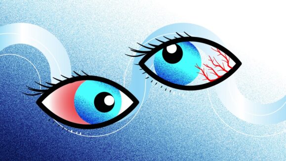 Pathogen Detection and Immune Response in Uveitis Management Current Approaches and Future Directions