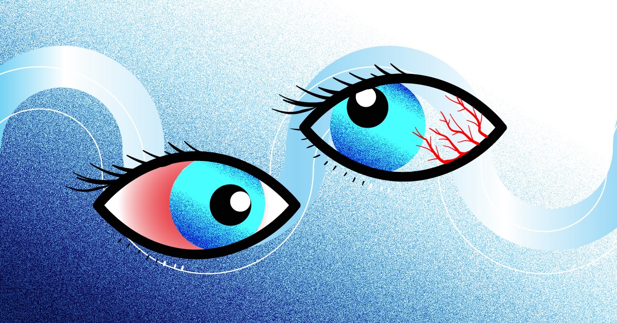 Pathogen Detection and Immune Response in Uveitis Management Current Approaches and Future Directions