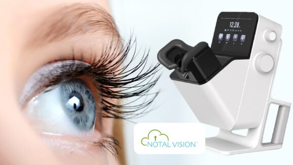 AI Powered Notal Vision SCANLY_THUMBNAIL