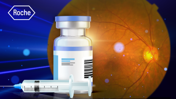 Thumbnail website _ 1200x675_Roche Vabysmo Shows Promise in Treating Polypoidal Choroidal Vasculopathy (PCV) in Asian Patients_fix