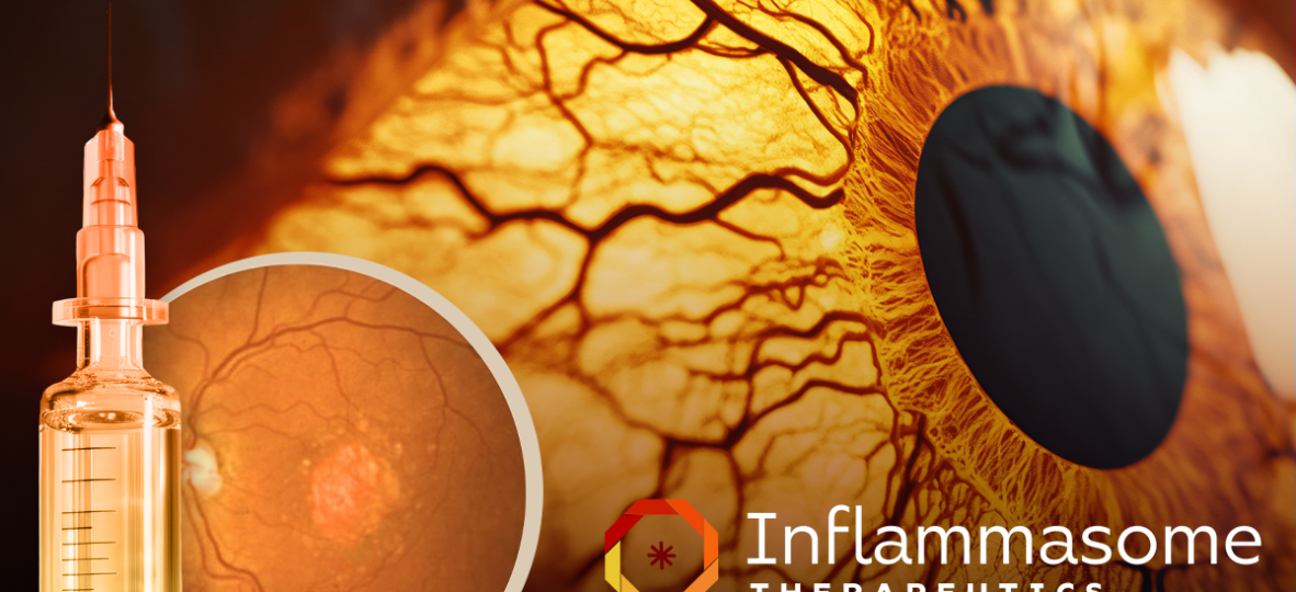 [Internal] Newsroom thumbnail Inflammasome Therapeutics Reports 3 Month Trial Data for Its Dual Inflammasome Inhibitor in Geographic Atrophy