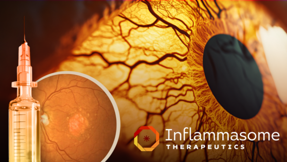 [Internal] Newsroom thumbnail Inflammasome Therapeutics Reports 3 Month Trial Data for Its Dual Inflammasome Inhibitor in Geographic Atrophy