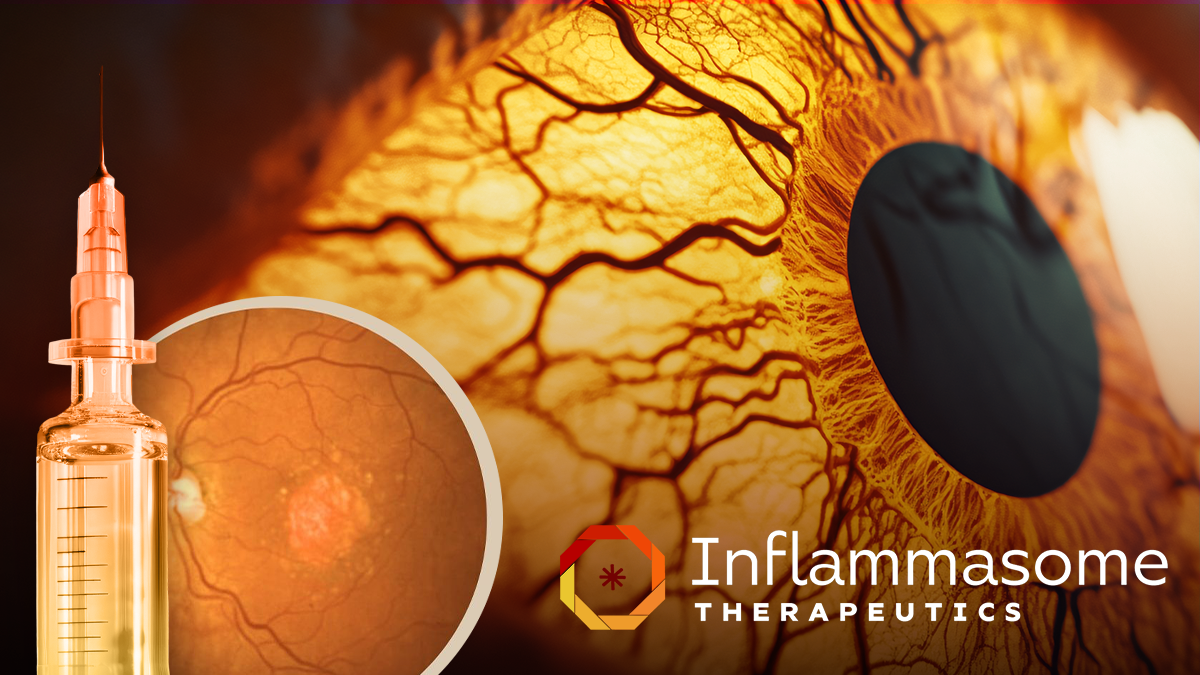 [Internal] Newsroom thumbnail Inflammasome Therapeutics Reports 3 Month Trial Data for Its Dual Inflammasome Inhibitor in Geographic Atrophy